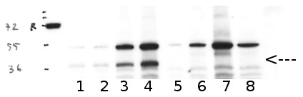 Western blot using anti/PPH1/TAP38 antibodies